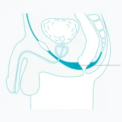 Schéma anatomique de la vessie et du plancher pelvien masculin, essentiel pour la rééducation vessie homme.