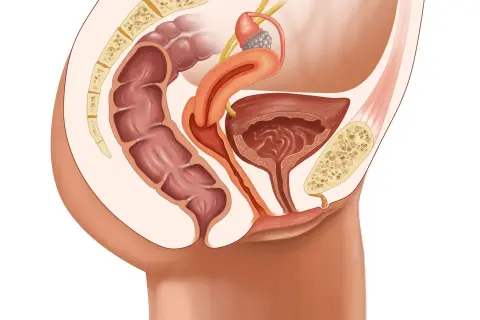 Anatomie pelvienne féminine montrant le côlon, la vessie, l'utérus et le sacrum. Illustration pour une opération prolapsus avis.