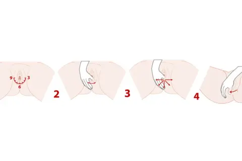 Illustrations montrant des exercices pour le périnée femme enceinte : étirement, massage et renforcement.