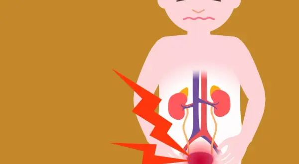 Douleur intense au bas du dos et à la vessie, suggérant une sciatique et une vessie hyperactive. L'image montre un schéma du système urinaire avec des éclairs rouges.