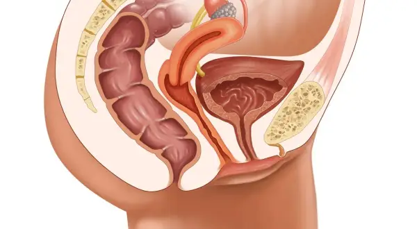 Anatomie pelvienne féminine montrant le côlon, la vessie, l'utérus et le sacrum. Illustration pour une opération prolapsus avis.