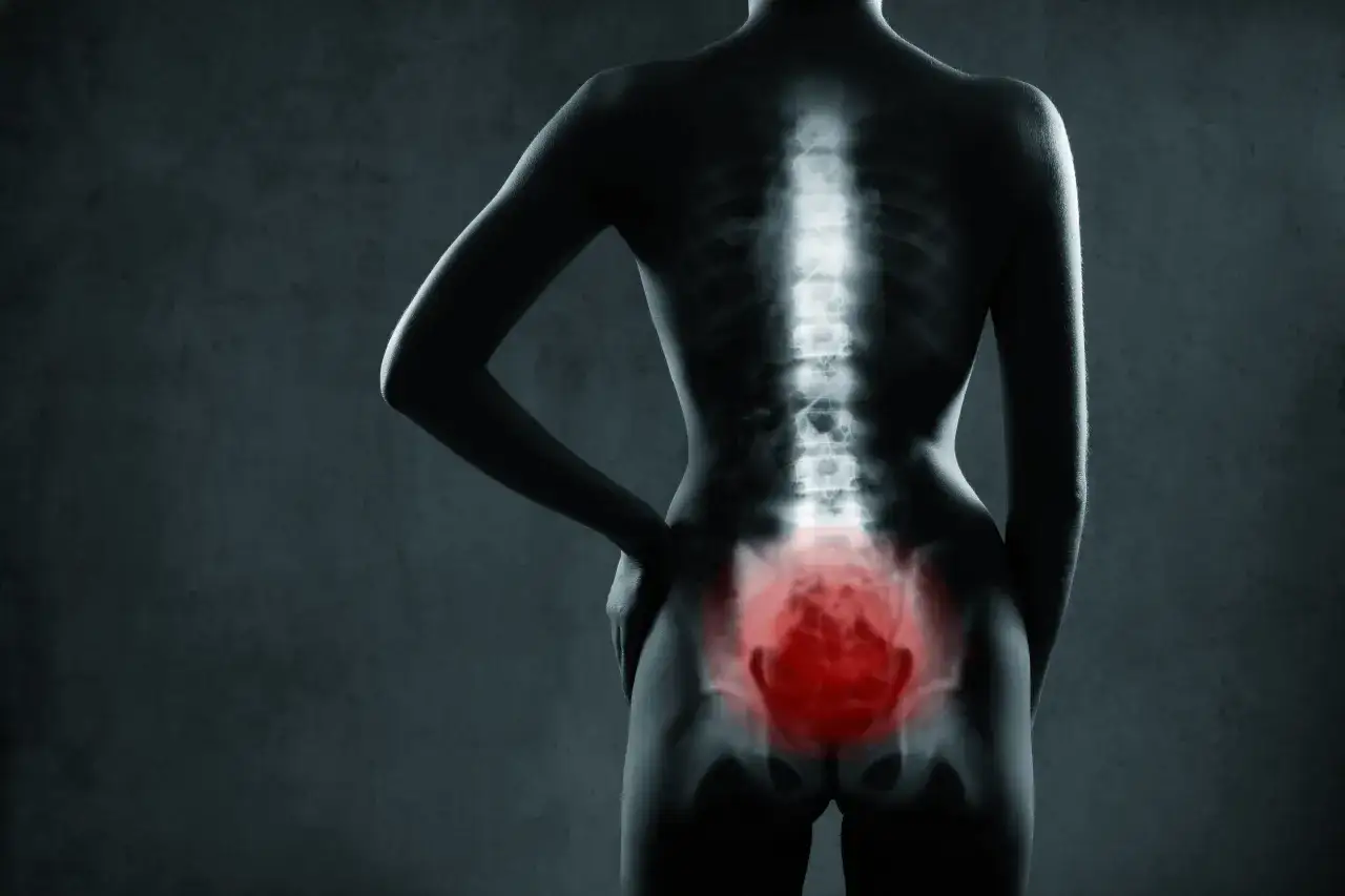 Radiographie du bassin et du bas du dos, mettant en évidence une zone rouge intense, suggérant des douleurs lombaires après promontofixation.