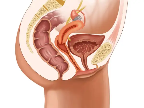 Anatomie pelvienne féminine montrant le côlon, la vessie, l'utérus et le sacrum. Illustration pour une opération prolapsus avis.